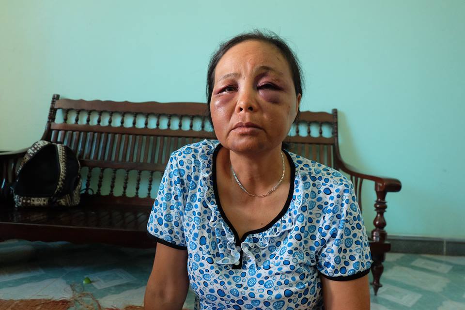 Bà bán tăm bị đánh được 'mong thông cảm', rút đơn