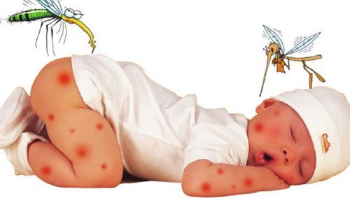 Nguyên nhân và dấu hiệu bệnh sốt rét