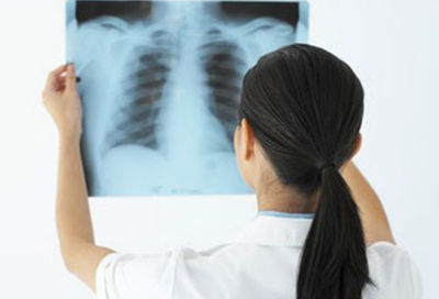 Nghe nước chảy trong phổi, cô gái 22 tuổi phát hiện bị ung thư