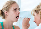 Điều trị ung thư lưỡi bằng phương pháp nào?
