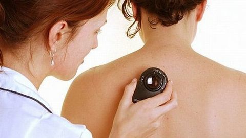 Các giai đoạn của ung thư da mà bạn nên biết