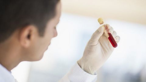 Các phương pháp điều trị ung thư bạch cầu thông thường