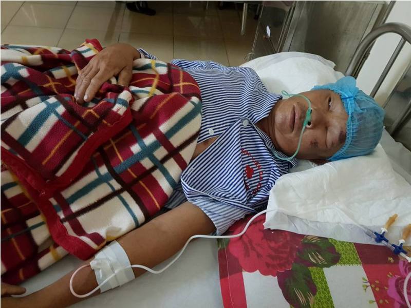 Chồng ngã giàn giáo vỡ sọ não, vợ bất lực cầu cứu