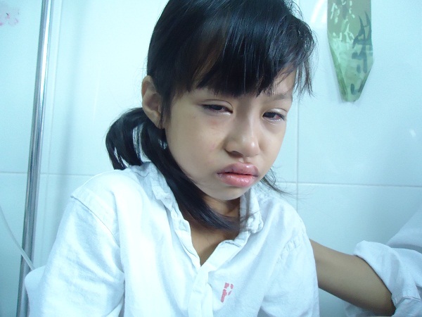 Mẹ nghèo khổ sở chăm con bị viêm tụy mãn tính