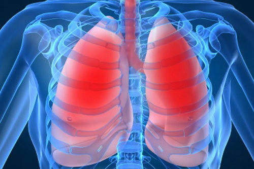 Điều trị bệnh viêm phổi