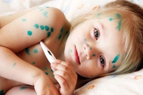 Biện pháp phòng bệnh truyền nhiễm hiệu quả