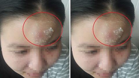 Nữ công nhân bị côn đồ vào tận nhà trọ hành hung