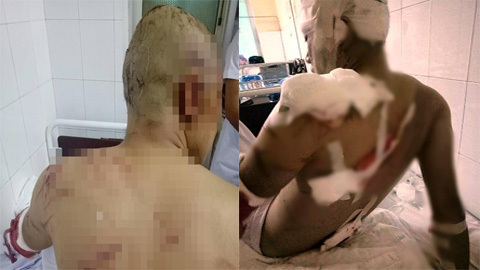 Bị chém hàng chục nhát, thanh niên giả chết thoát thân