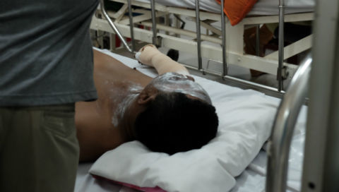 Nổ tủ điện, 3 người bị bỏng nặng