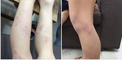 Chủ tịch HN: Làm rõ vụ 11 học sinh lớp 2 bị giáo viên bạo hành
