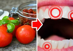 10 loại thực phẩm làm hại răng của bạn