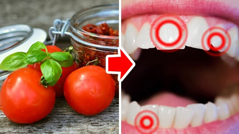 10 loại thực phẩm làm hại răng của bạn