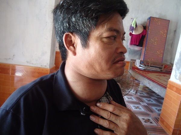 Người đàn ông câm điếc bất lực vì không tiền phẫu thuật bướu cổ