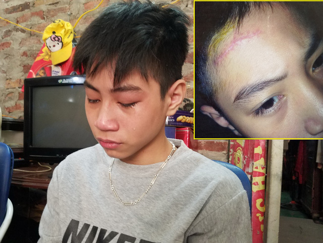 Học sinh trường xiếc và học sinh du học