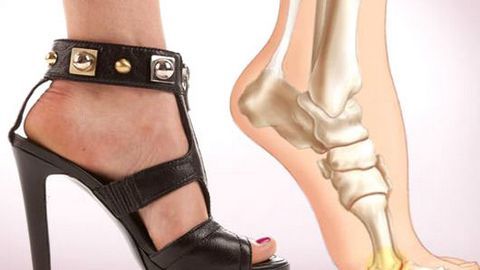 Phòng và chữa đau mỏi chân khi đeo giày cao gót thường xuyên
