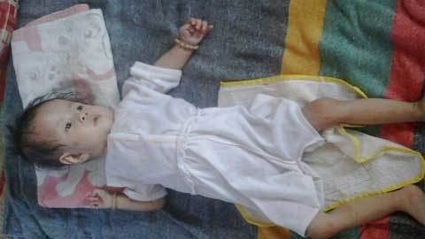 Bé gái suy tim nặng chờ cha kiếm tiền 10 năm...