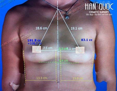 Truyện Cô Vợ Cưng Sủng Của Hắc Đế