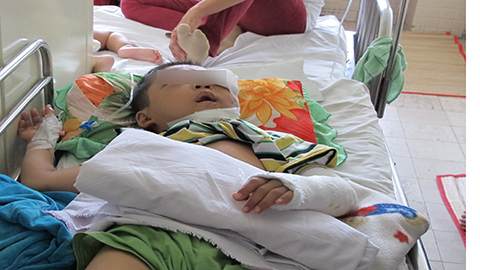 TPHCM: Bố mẹ đi vắng,  anh em rớt lầu