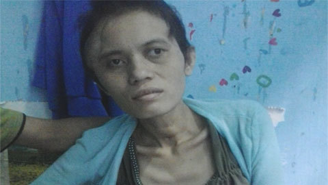 Mở hộp sọ chữa bệnh rồi thiếu tiền ráp lại