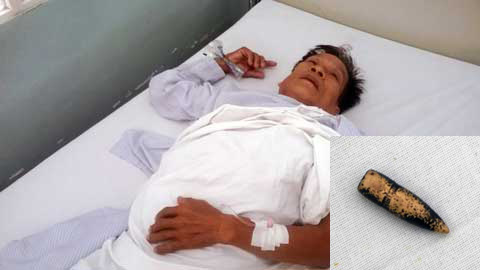 Người nông dân 40 năm 'sống chung' với đầu đạn