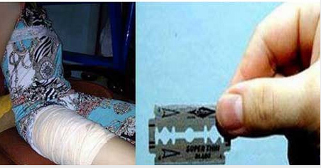 Nữ sinh bị 'rạch đùi' chỉ là tin đồn thất thiệt