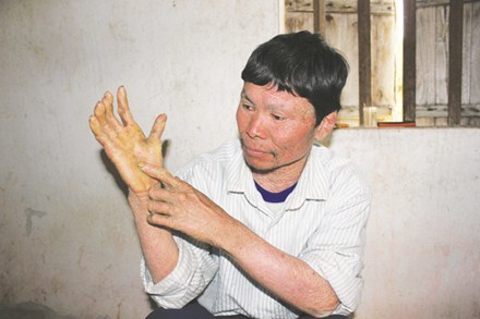 Gia tộc “giời đày”
