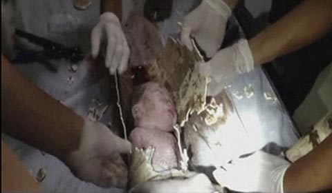 Giải cứu bé sơ sinh mắc kẹt trong ống dẫn nước thải