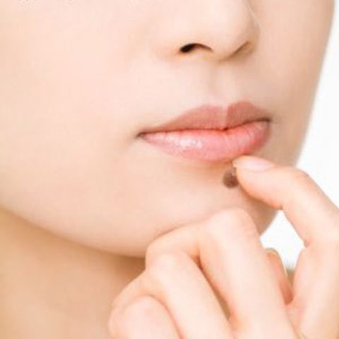 Rước họa vì tẩy nốt ruồi bằng axit