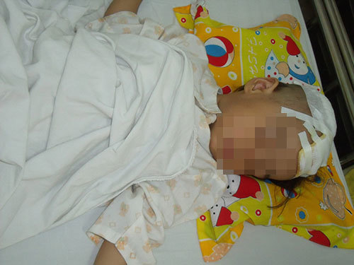 Dồn dập tai nạn trẻ em mùa hè