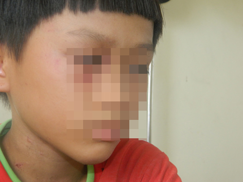 Đánh con dã man rồi bắt viết nhật ký