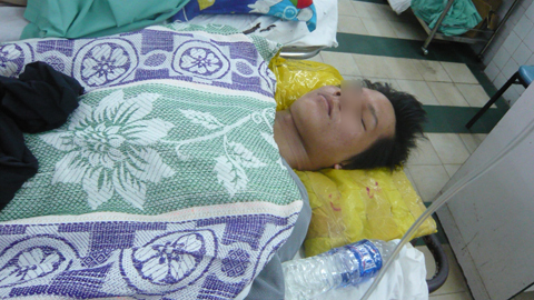 Pha thoát chết hy hữu khi rơi từ tầng 12