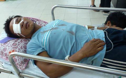 Bắn nhau kinh hoàng trên biển, nhiều người bị thương