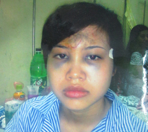 Chiêu độc của giang hồ đất Cảng: 