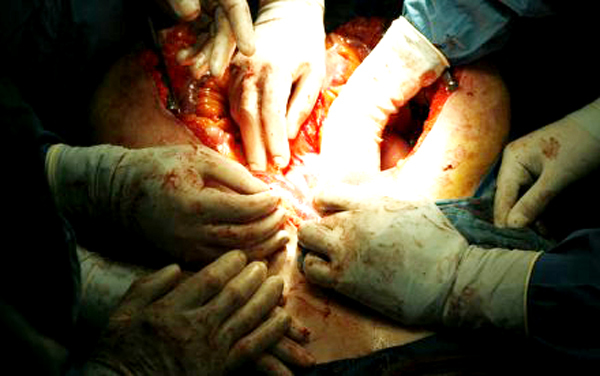 Buôn bán nội tạng, ở Việt Nam: 150 triệu đồng/quả thận