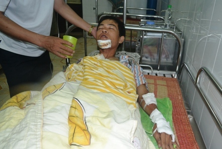 Chống đua xe, một CSGT nguy kịch