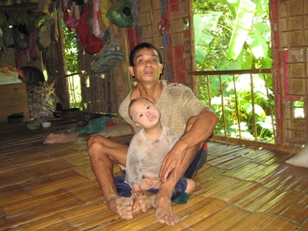 Nỗi khổ gia đình 2 bố con cùng mắc bệnh tâm thần