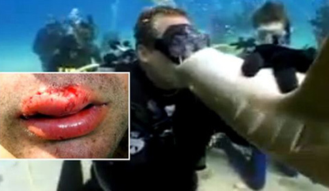 Rách môi vì hôn... cá mập