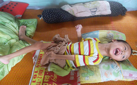 Xót cảnh ông bà bệnh tật nuôi đứa cháu bại não