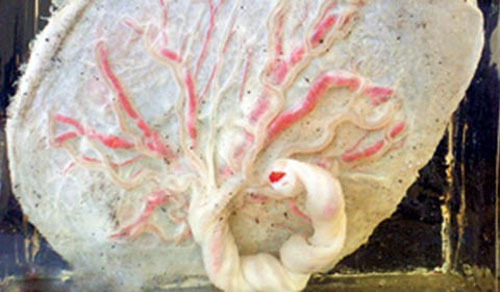 Thực hư chuyện ăn nhau thai tốt cho sức khỏe