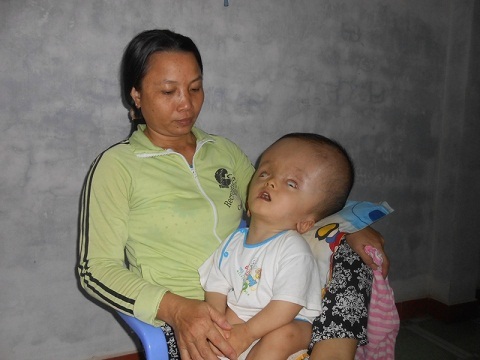 Gia đình có con nuôi bị bệnh não úng thủy cầu cứu
