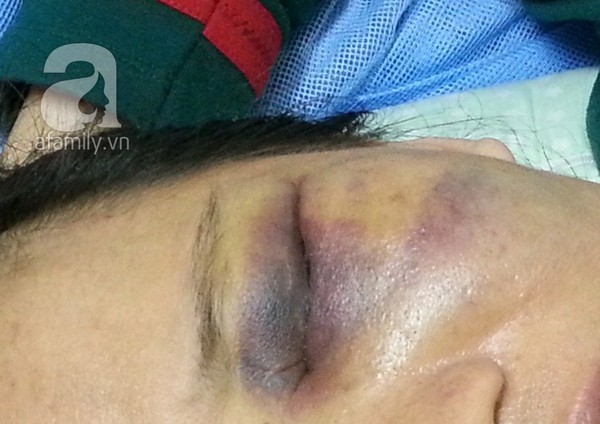 Hà Nội: Chồng đánh vợ vào vùng kín