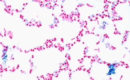 độc tố, chất độc, Clostridium botulinum, tiêm Botox, thểm mỹ, xóa nếp nhăn