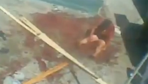 Kinh hoàng người phụ nữ bị chó pitbull tấn công