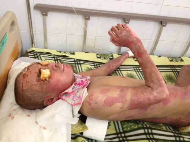 Em nó mất rồi, xin mọi người cứu lấy thằng anh…