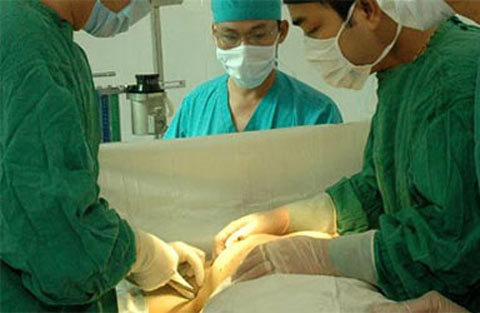 Giây phút kinh hoàng trên bàn phẫu thuật thẩm mỹ
