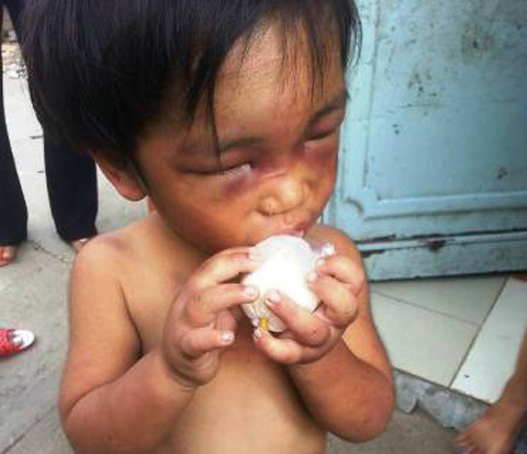 Cháu bé 3 tuổi bị cậu đánh đập dã man, bắt đi ăn xin