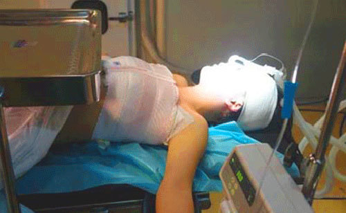 Những cái chết đau lòng vì nâng ngực ở Sài thành