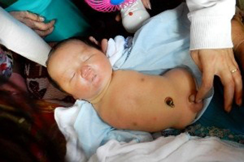 Thêm một 'Nick Vujicic' ra đời ở An Giang