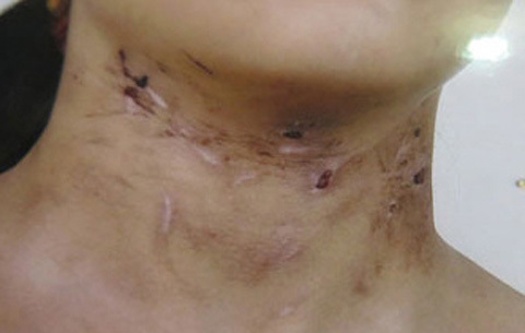 Khởi tố kẻ đánh con gái 6 tuổi, bỏ lại nghĩa trang