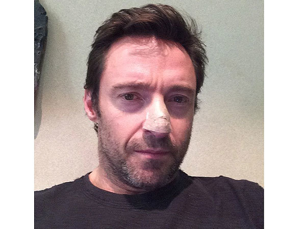 Người sói' Hugh Jackman chiến đấu với ung thư da